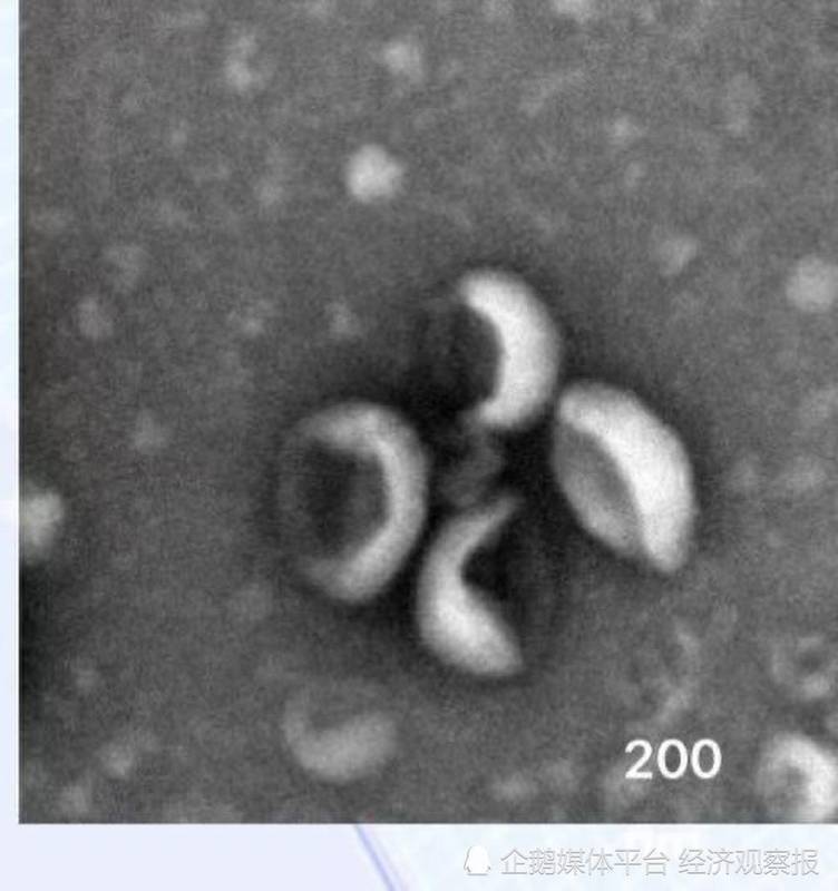  外泌体行业整顿之后；正规头部企业迎来投资热潮。 健康养生